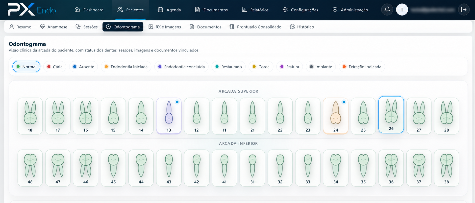 Odontograma do PX Endo com status clínicos por dente